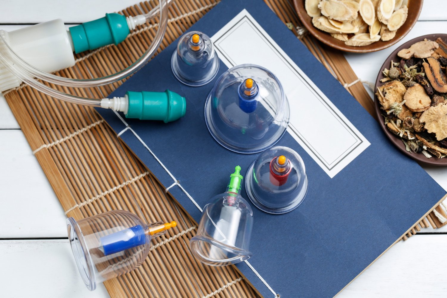 cupping